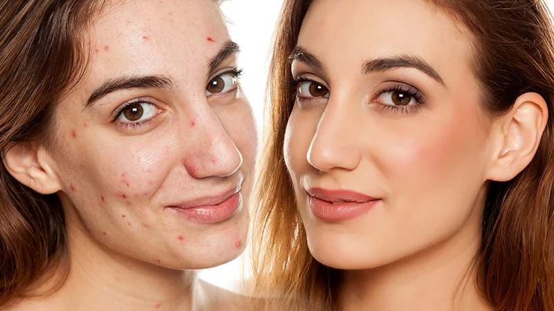 Soothing & Sensitive Repair